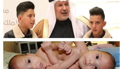 بعد 12 عاما .. الربيعة يستقبل التوأم السيامي الأردني أمجد ومحمد 