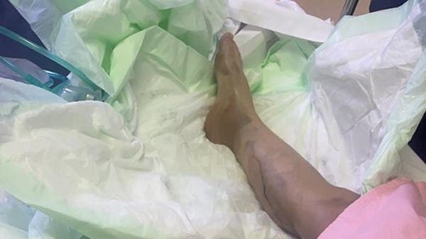 تفاصيل صادمة عن حرق زوجته بالحامض في جدة .. وهذه وصيتها 