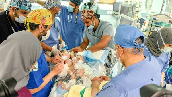 السعودية.. نجاح عملية فصل التوأم السيامي العراقي “علي وعمر”