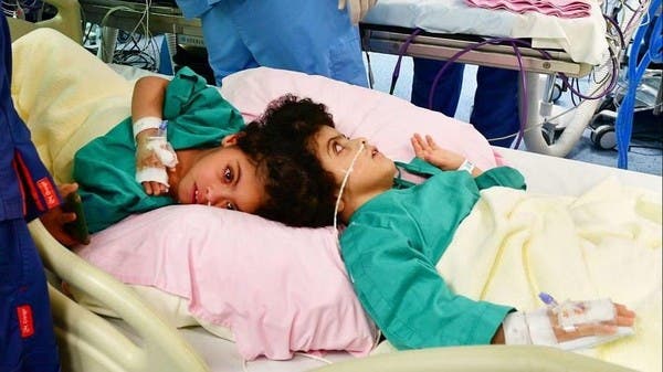 بعد 17 ساعة.. نجاح فصل السيامي المصري سلمى وسارة بالسعودية