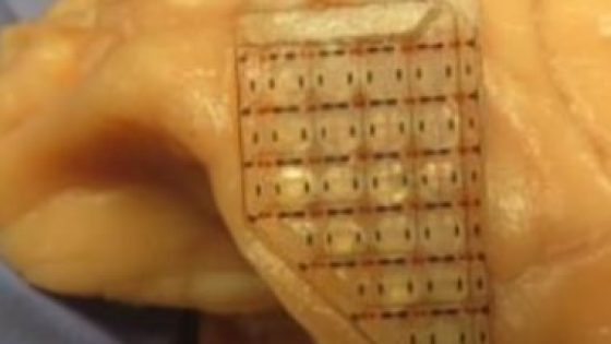 نهاية إدمان القمار.. علماء يطورون شريحة دماغية تقلل من المخاطرة